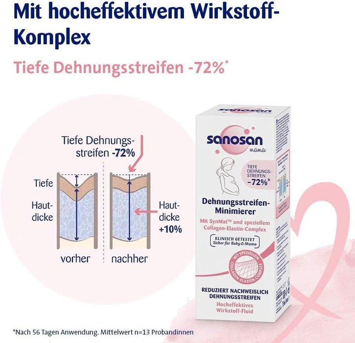 Sanosan Stretch Mark Minimiser, testat clinic - dovedit a reduce vergeturile după sarcină, fără ulei de parafină, coloranți, siliconi, 75 ml Cosmetice si Infrumusetare Naty Shop