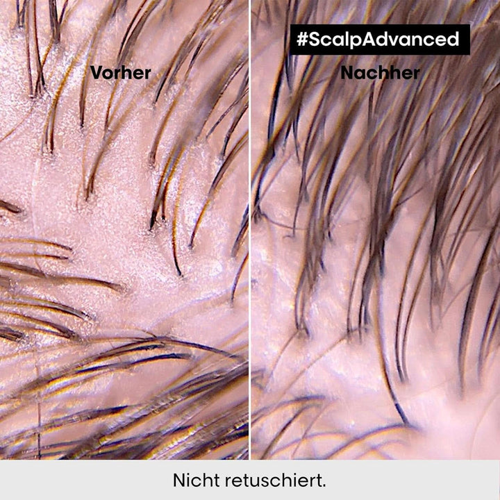 L'Oréal Professionnel Șampon de păr pentru curățarea scalpului gras, 300 ml Duș și baie Naty Shop